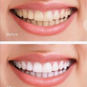 Black ginseng toothpaste